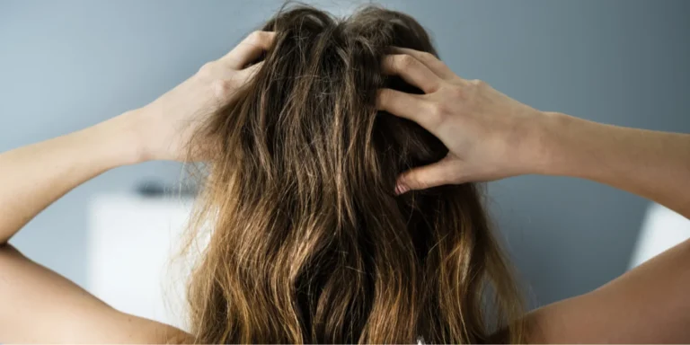 Dandruff vs. Dry Scalp: Differences & Remedies