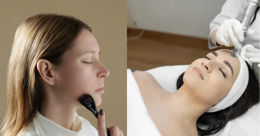 dermarolling-vs.-microneedling. which one suits you best?